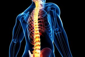 قوز كمر و طرق مقابله با آن