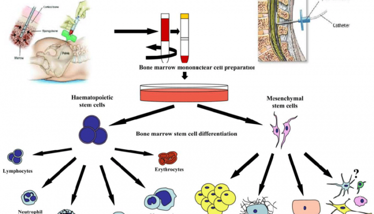 ساختار وطبقه بندي آنتي بادي