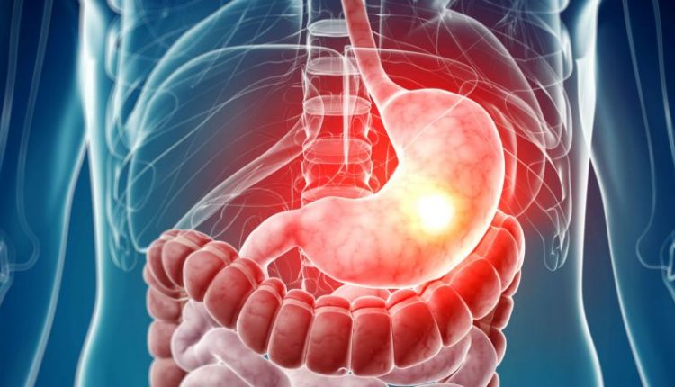 بررسي فراواني افسردگي در بيماران مبتلا به ديس پپسي